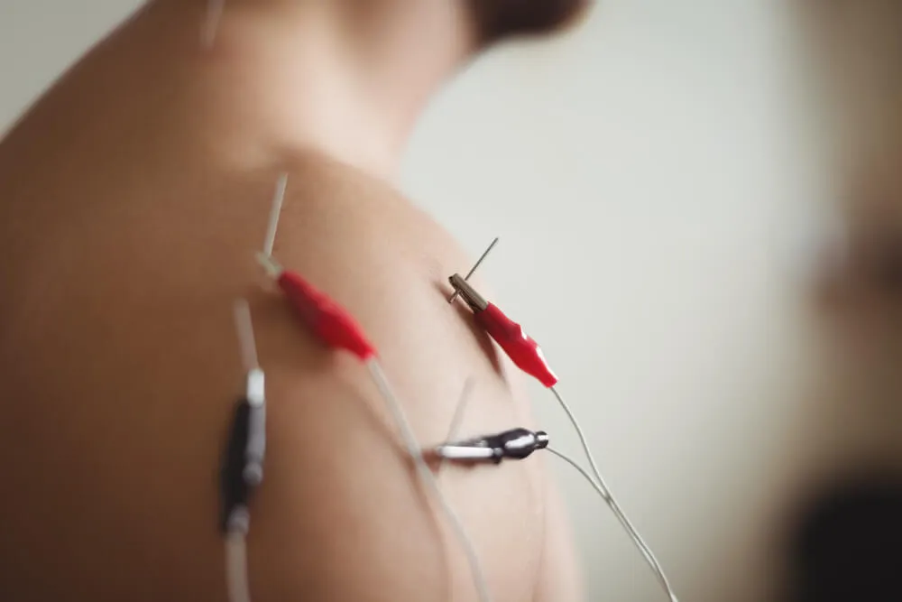 Neuromodulación invasiva